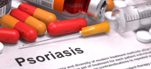 psoriasis medication