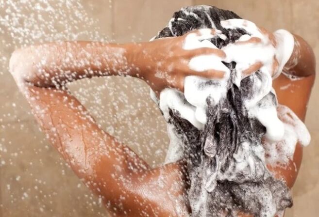 Shampoos of psoriasis