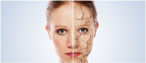 We treat psoriasis