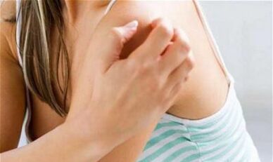 girl scratching her shoulder